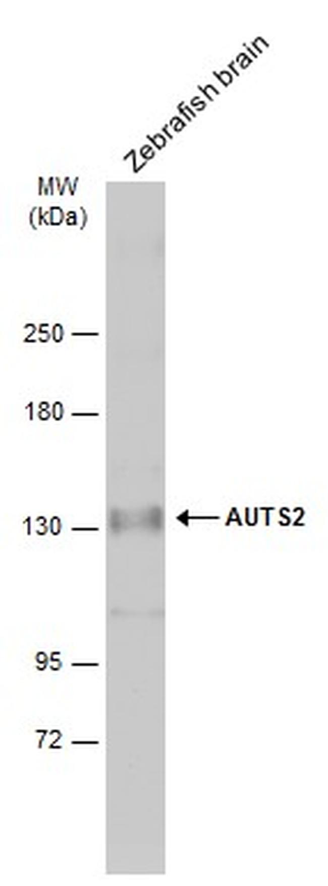 AUTS2 Antibody in Western Blot (WB)