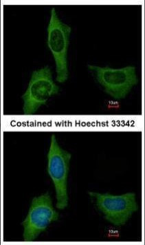 Factor X/Xa Antibody in Immunocytochemistry (ICC/IF)