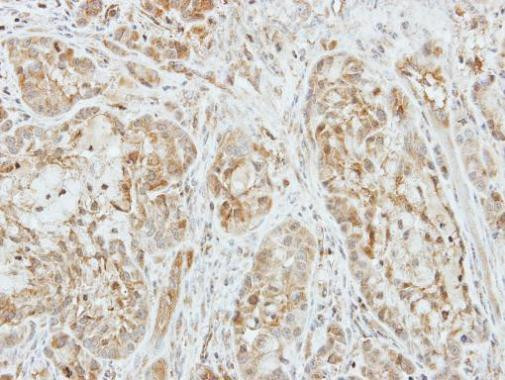 Factor X/Xa Antibody in Immunohistochemistry (Paraffin) (IHC (P))