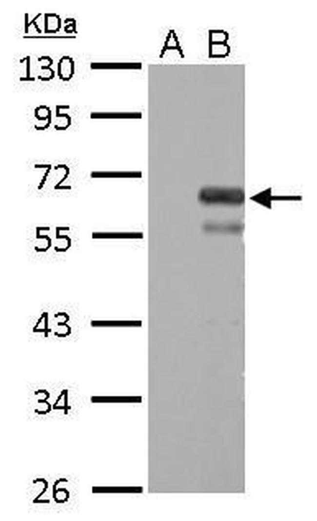 Factor X/Xa Antibody in Western Blot (WB)