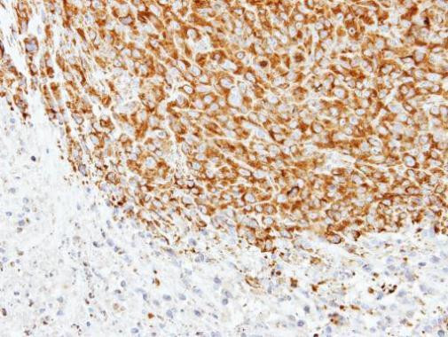 TUBA1A Antibody in Immunohistochemistry (Paraffin) (IHC (P))