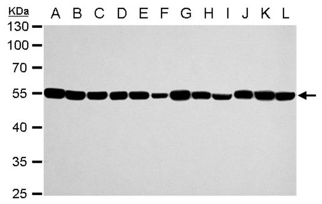 TUBA1A Antibody in Western Blot (WB)