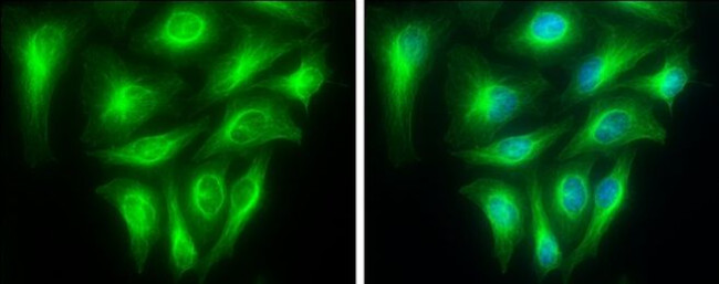 TUBA1A Antibody in Immunocytochemistry (ICC/IF)