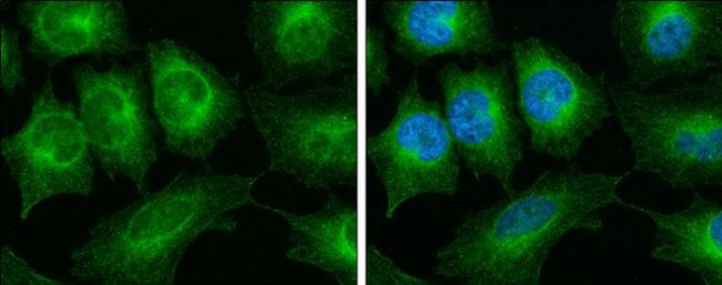 TUBA1A Antibody in Immunocytochemistry (ICC/IF)