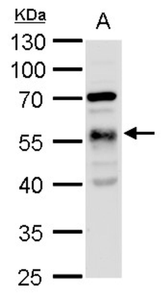 TUBA1A Antibody in Western Blot (WB)