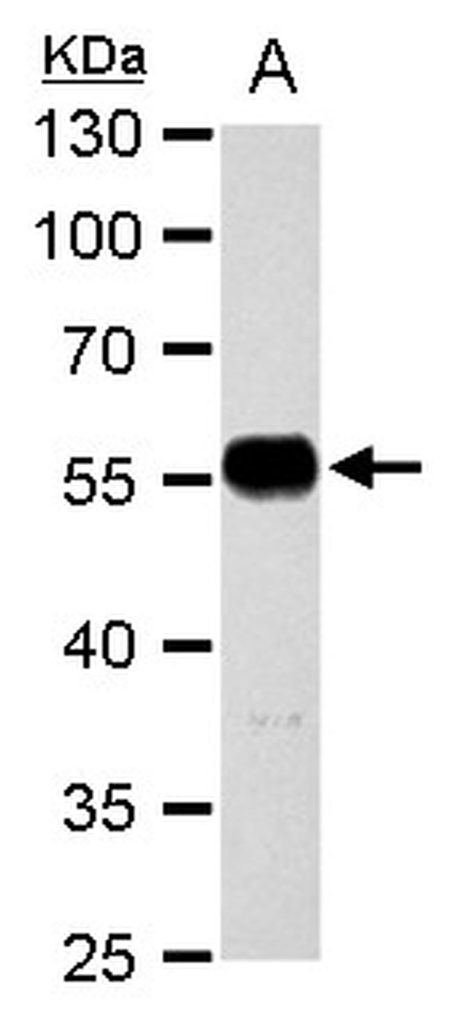 TUBA1A Antibody in Western Blot (WB)