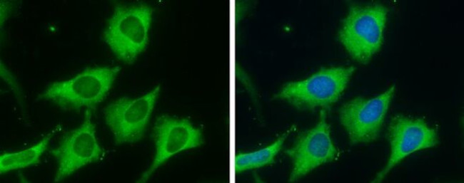 FASN Antibody in Immunocytochemistry (ICC/IF)