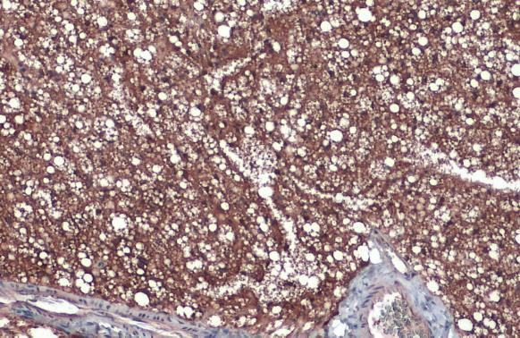 FASN Antibody in Immunohistochemistry (Paraffin) (IHC (P))