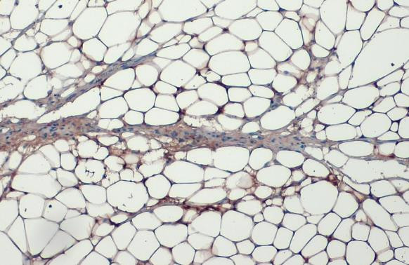 FASN Antibody in Immunohistochemistry (Paraffin) (IHC (P))