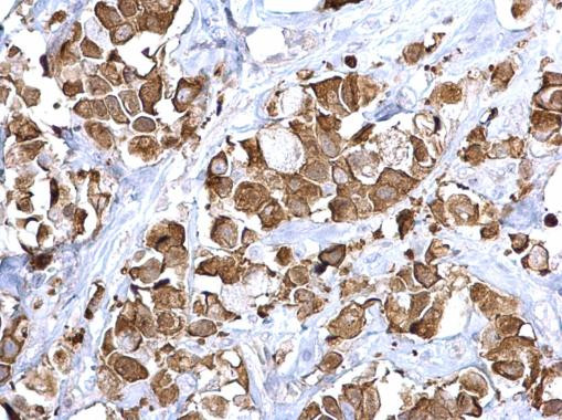 FASN Antibody in Immunohistochemistry (Paraffin) (IHC (P))