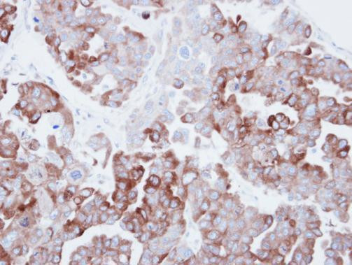 FASN Antibody in Immunohistochemistry (Paraffin) (IHC (P))