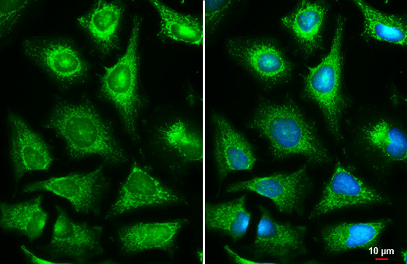 Fumarase Antibody in Immunocytochemistry (ICC/IF)