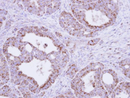 Fumarase Antibody in Immunohistochemistry (Paraffin) (IHC (P))