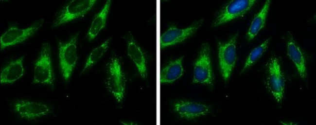 Fumarase Antibody in Immunocytochemistry (ICC/IF)