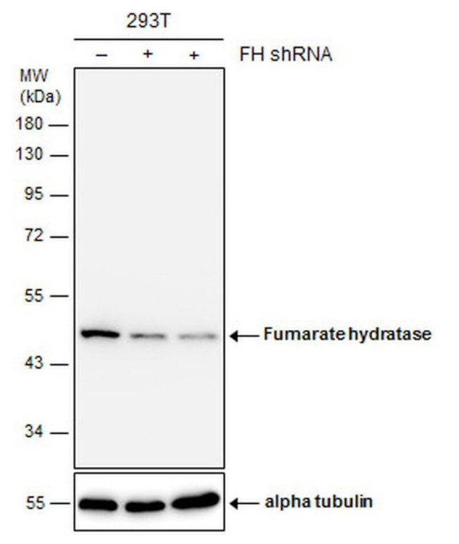 Fumarase Antibody