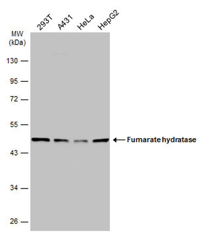 Fumarase Antibody in Western Blot (WB)