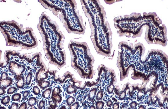 RBM15 Antibody in Immunohistochemistry (Paraffin) (IHC (P))