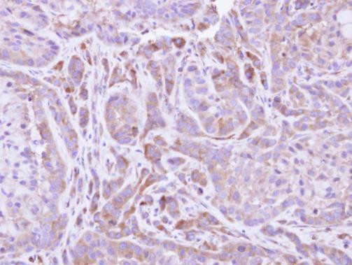 FMO2 Antibody in Immunohistochemistry (Paraffin) (IHC (P))