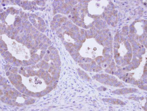 TCP-1 epsilon Antibody in Immunohistochemistry (Paraffin) (IHC (P))