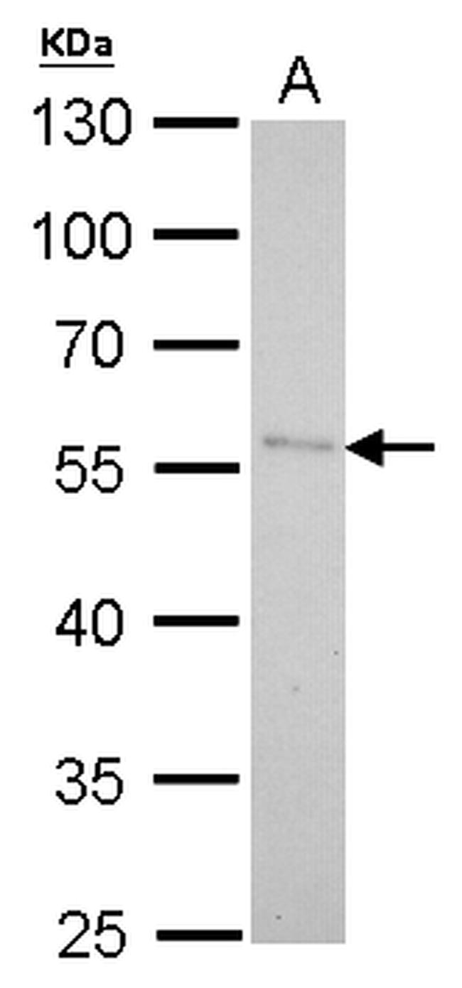 PNLIP Antibody in Western Blot (WB)