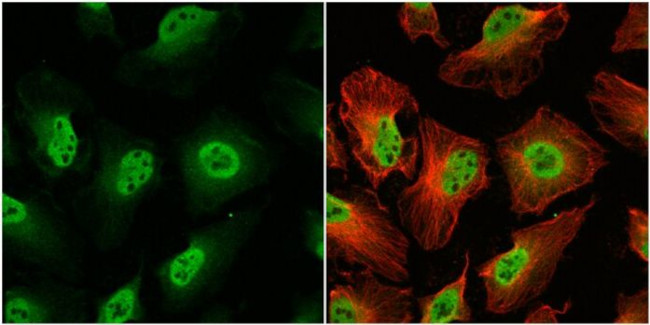 OGT Antibody in Immunocytochemistry (ICC/IF)