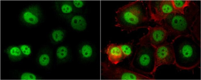 OGT Antibody in Immunocytochemistry (ICC/IF)