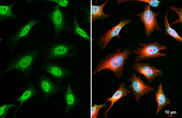 OGT Antibody in Immunocytochemistry (ICC/IF)