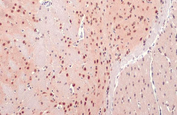 OGT Antibody in Immunohistochemistry (Paraffin) (IHC (P))