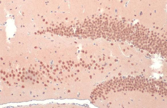 OGT Antibody in Immunohistochemistry (Paraffin) (IHC (P))