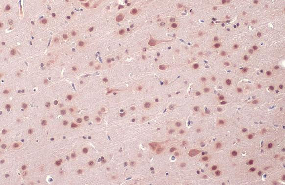 OGT Antibody in Immunohistochemistry (Paraffin) (IHC (P))