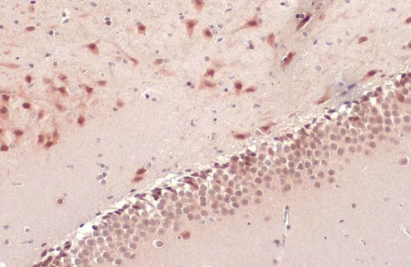 OGT Antibody in Immunohistochemistry (Paraffin) (IHC (P))