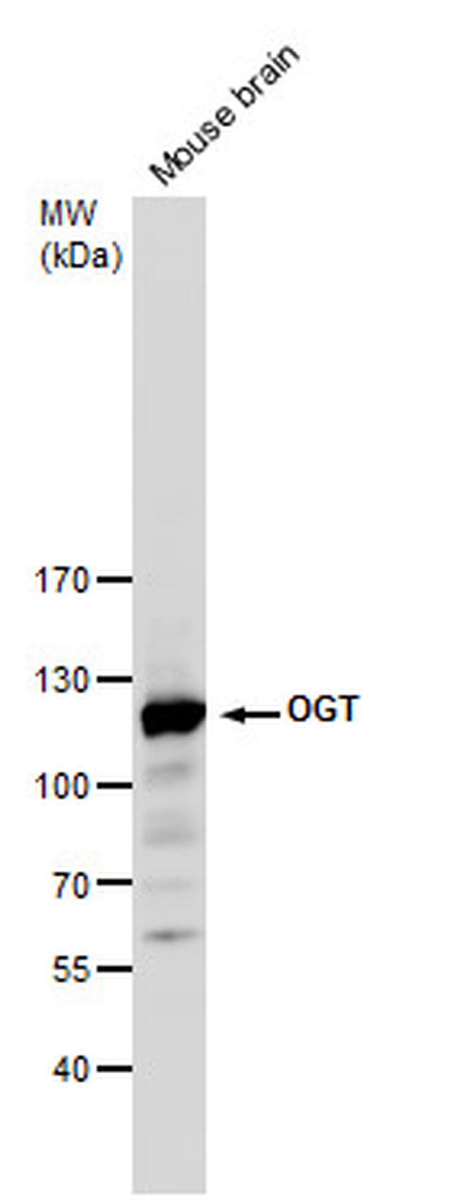 OGT Antibody in Western Blot (WB)