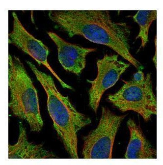 Villin Antibody in Immunocytochemistry (ICC/IF)