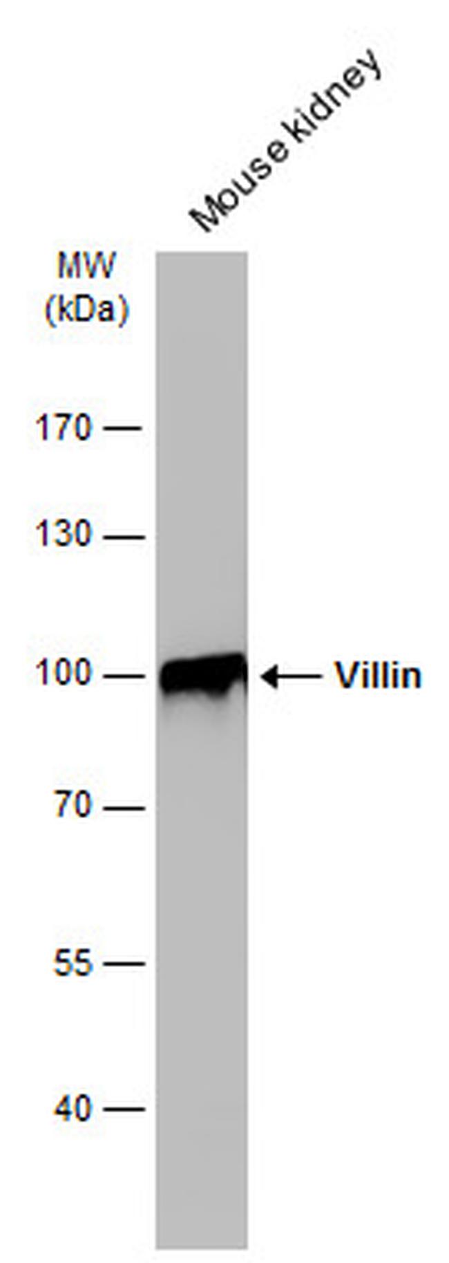 Villin Antibody in Western Blot (WB)