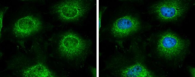 LARS2 Antibody in Immunocytochemistry (ICC/IF)