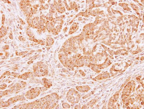 LARS2 Antibody in Immunohistochemistry (Paraffin) (IHC (P))