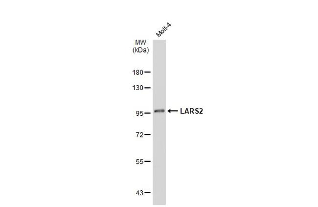LARS2 Antibody in Western Blot (WB)