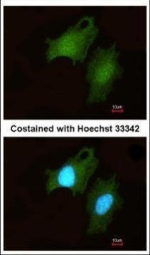 DIP2B Antibody in Immunocytochemistry (ICC/IF)