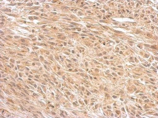 OGT Antibody in Immunohistochemistry (Paraffin) (IHC (P))