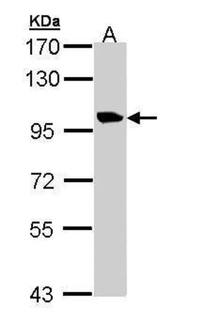 TMEM67 Antibody in Western Blot (WB)