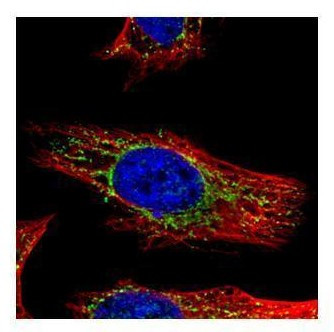 GALNS Antibody in Immunocytochemistry (ICC/IF)