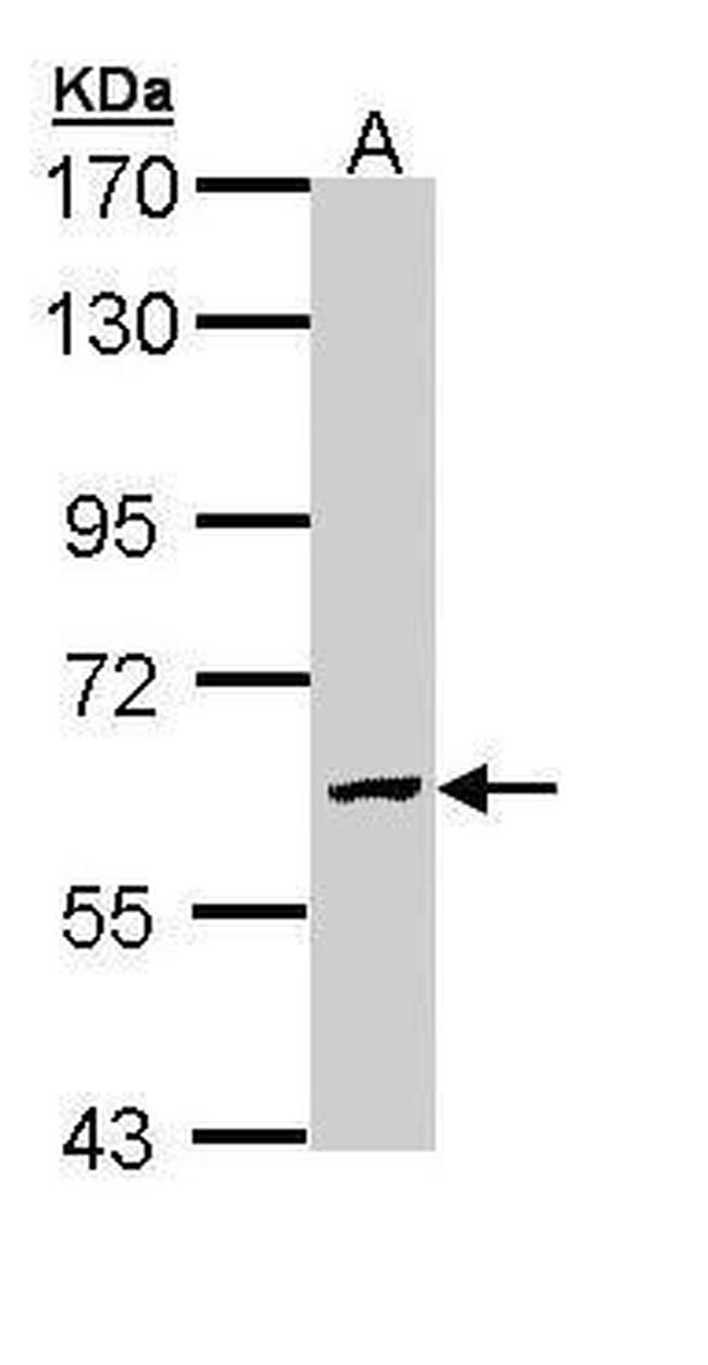 GALNS Antibody in Western Blot (WB)