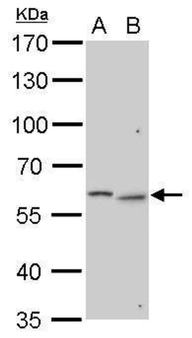 GALNS Antibody in Western Blot (WB)