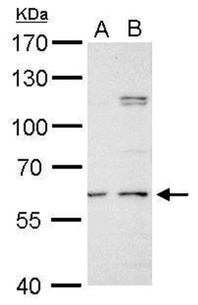 GALNS Antibody in Western Blot (WB)