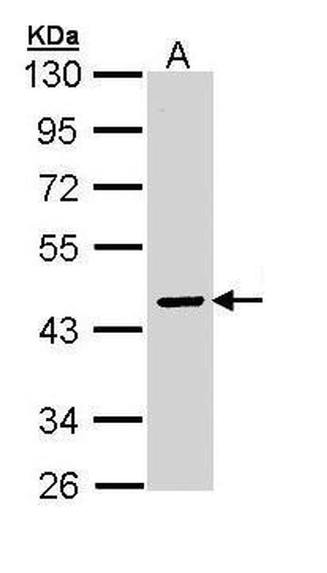 SERPINA10 Antibody in Western Blot (WB)