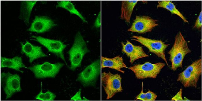 MX1 Antibody in Immunocytochemistry (ICC/IF)