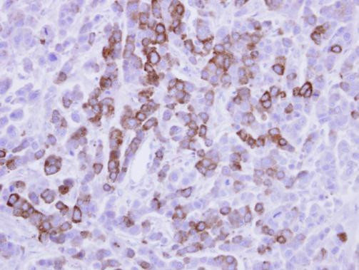 MX1 Antibody in Immunohistochemistry (Paraffin) (IHC (P))