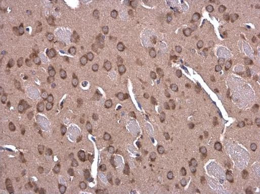 GLDC Antibody in Immunohistochemistry (Paraffin) (IHC (P))