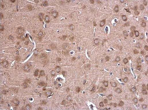 GLDC Antibody in Immunohistochemistry (Paraffin) (IHC (P))