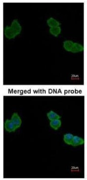 Aminoacylase Antibody in Immunocytochemistry (ICC/IF)